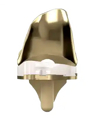 Vista frontal de prótesis dorada para reemplazo de rodilla