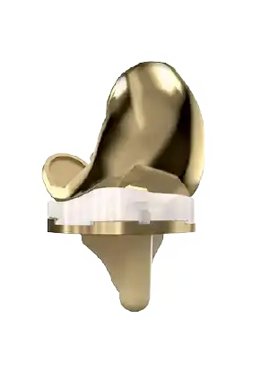 Vista trasera de prótesis dorada para reemplazo de rodilla