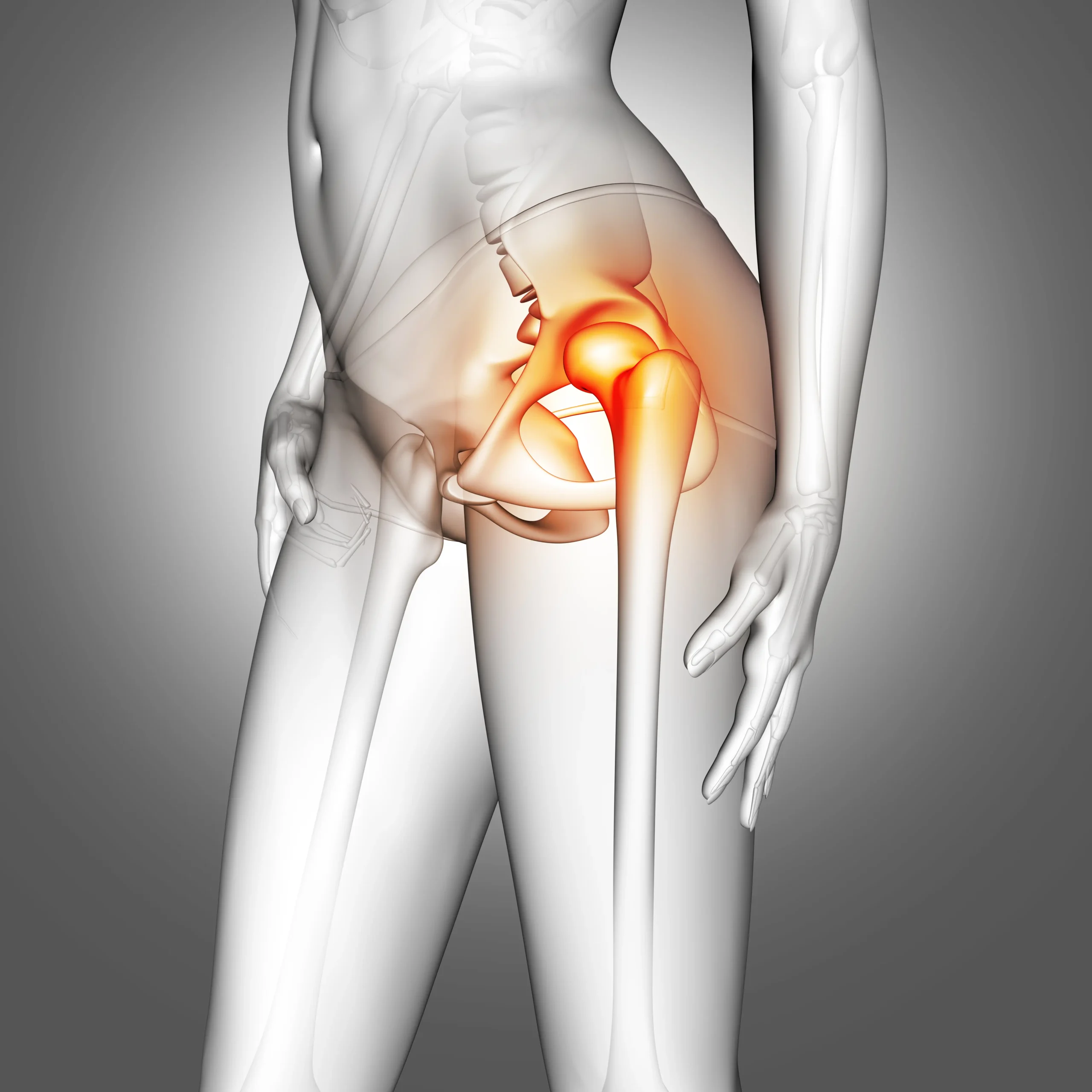 Ilustration of a hip with pain