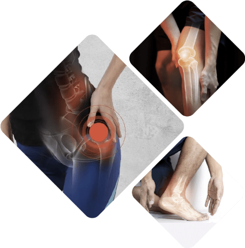 Traumatólogo que brinda atención a cadera y rodilla